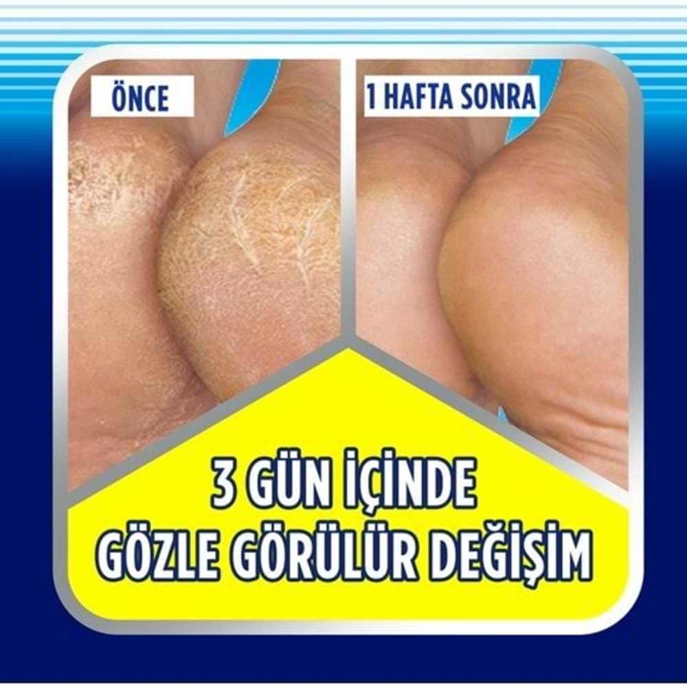 Scholl Topuk Çatlağı Bakım Kremi