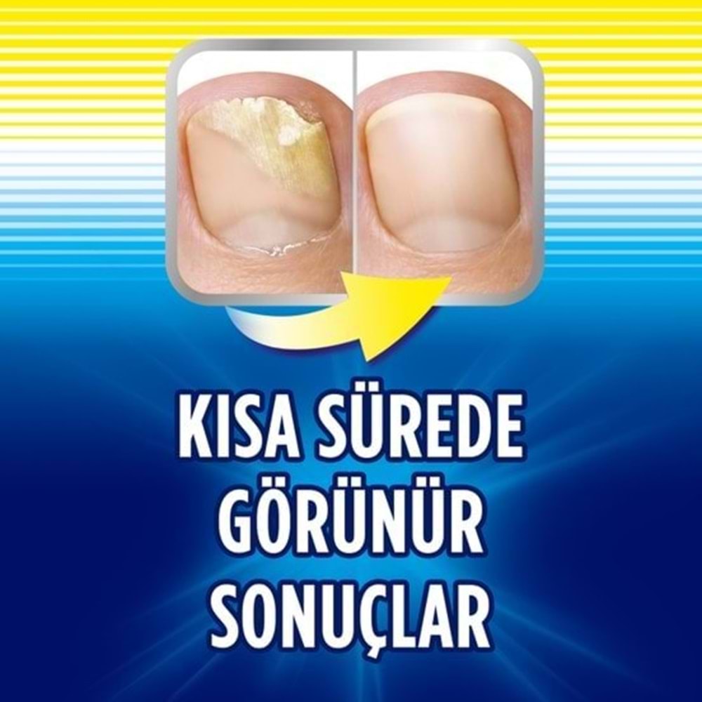 Scholl Tırnak Mantar Tedavisi Mantar Giderici